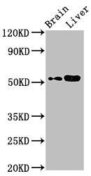 CHST9 Antibody (PACO53478)