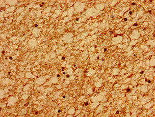 SACS Antibody (PACO54202)