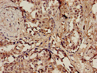 POLE Antibody (PACO54226)