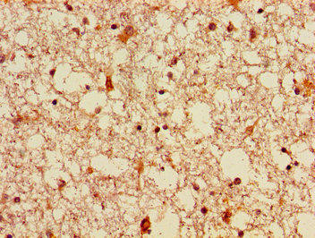 FGF22 Antibody (PACO54774)