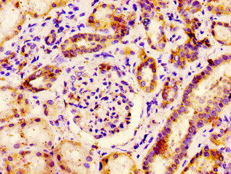 PCSK6 Antibody (PACO55718)