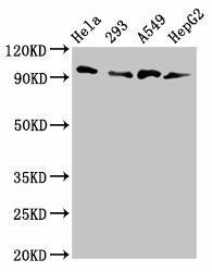 MACC1 Antibody (PACO55982)