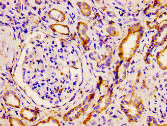 PNPLA6 Antibody (PACO56010)