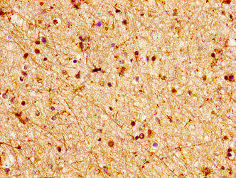 LGI2 Antibody (PACO56034)