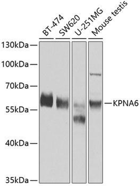 Anti-KPNA6 Antibody (CAB7363)