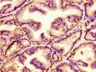 JMY Antibody (PACO56078)