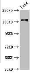 MAN2B2 Antibody (PACO56250)