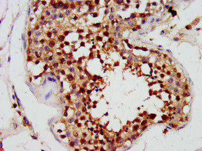 PHOX2A Antibody (PACO56924)
