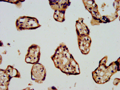 CDC42BPB Antibody (PACO57052)