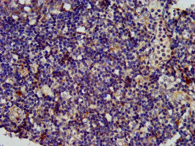 SPINK6 Antibody (PACO57220)