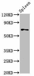 SSH3 Antibody (PACO57340)
