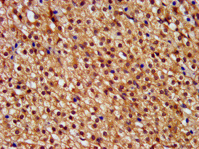 PNPLA8 Antibody (PACO57472)