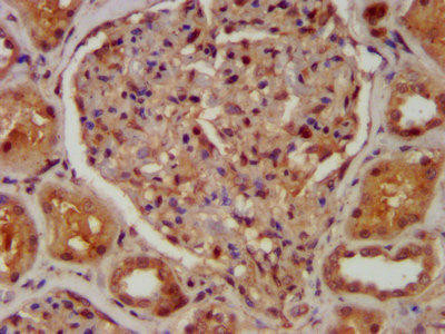 CABP4 Antibody (PACO57684)