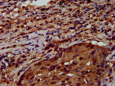 RNF43 Antibody (PACO57948)