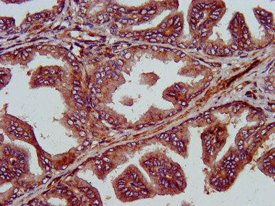 GINS1 Antibody (PACO58128)