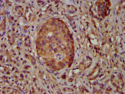 NEK5 Antibody (PACO58192)