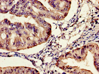 SYNE2 Antibody (PACO58352)