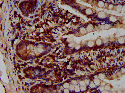 VPS52 Antibody (PACO58412)