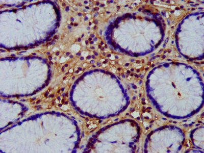 WNT8A Antibody (PACO58472)