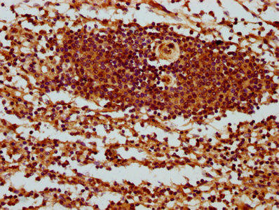 SH3BP1 Antibody (PACO59021)