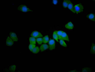 SH3RF1 Antibody (PACO59197)