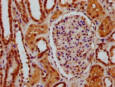 SSBP3 Antibody (PACO59441)