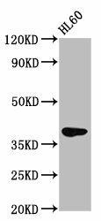 GPR174 Antibody (PACO59509)