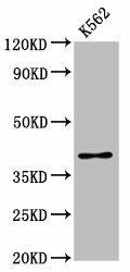PRB1 Antibody (PACO59864)