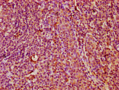 KLRC3 Antibody (PACO59948)