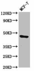 TFAP2E Antibody (PACO60172)