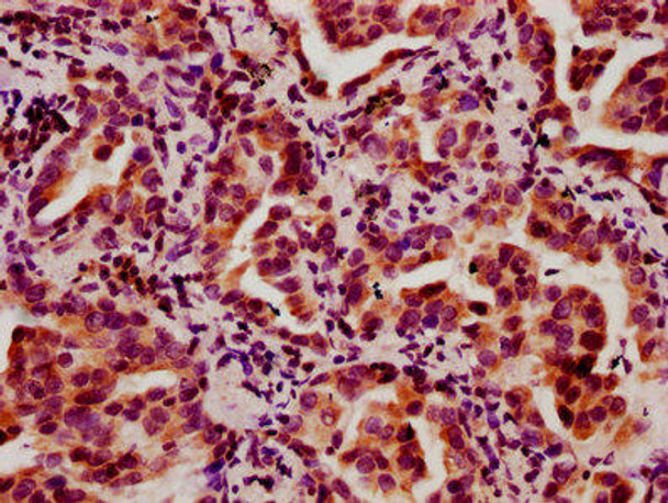 HIST1H2BC (Ab-5) Antibody (PACO60472)