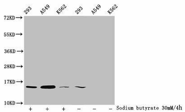 Acetyl-HIST1H2BC (K11) Antibody (PACO60474)