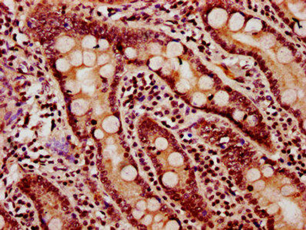 HIST1H2BC (Ab-11) Antibody (PACO60476)