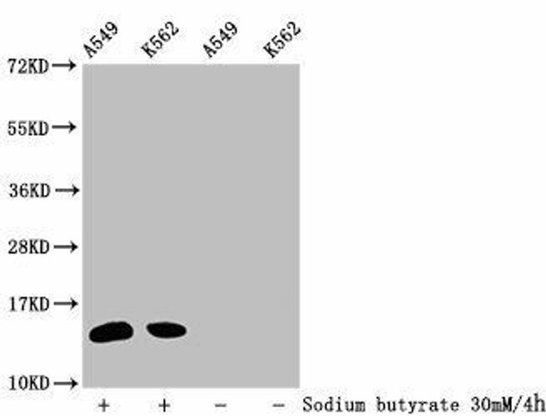 2-hydroxyisobutyryl-HIST1H2BC (K34) Antibody (PACO60484)