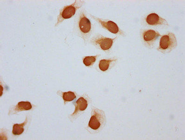 Acetyl-HIST1H2BC (K108) Antibody (PACO60493)
