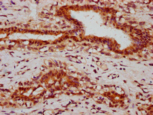 HIST1H2BC (Ab-5) Antibody (PACO60587)