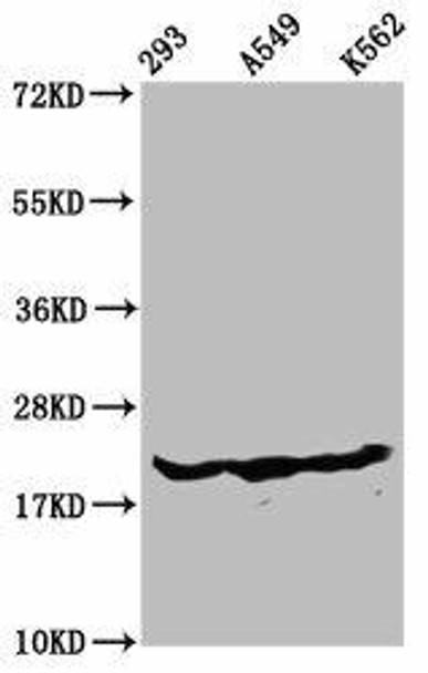 beta -hydroxybutyryl-HIST1H1D (K75) Antibody (PACO60591)
