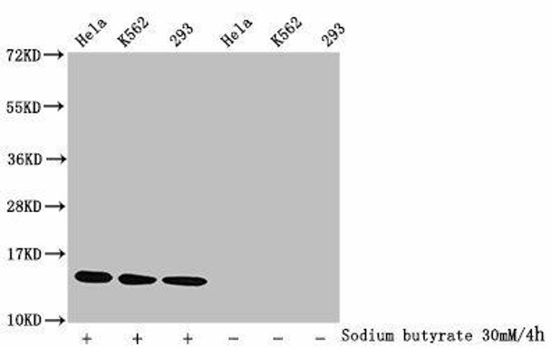 Acetyl-HIST1H2BC (K15) Antibody (PACO60597)