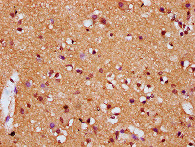 DIRAS1 Antibody (PACO60685)