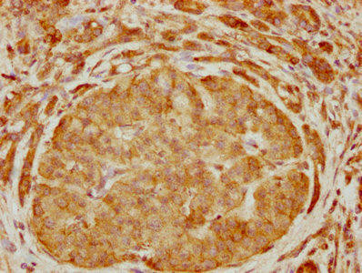 ARHGEF6 Antibody (PACO61374)