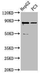 CCDC170 Antibody (PACO61482)