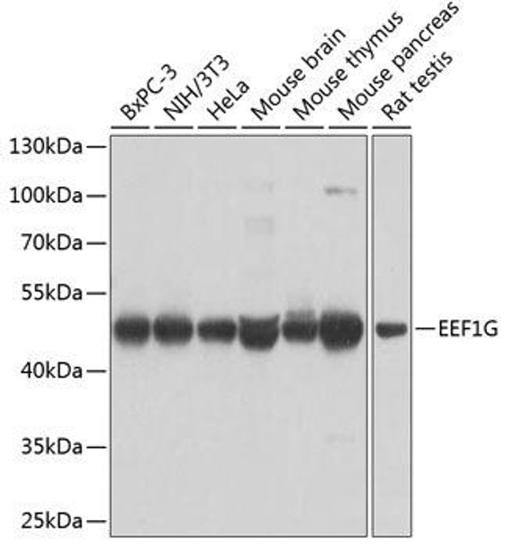 Anti-EEF1G Antibody (CAB7891)