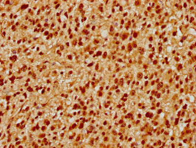 PRPF39 Antibody (PACO61638)