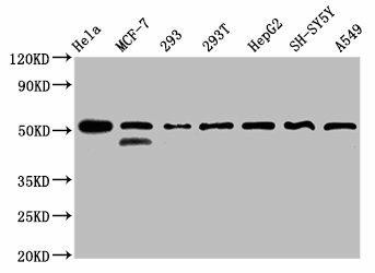 PLAGL1 Antibody (PACO61690)