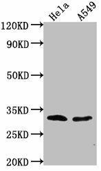 VAX2 Antibody (PACO61706)