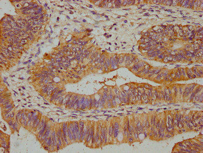DPH5 Antibody (PACO61722)