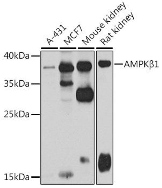 Anti-AMPKBeta1 Antibody (CAB7921)