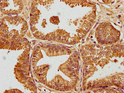 SKOR2 Antibody (PACO61931)