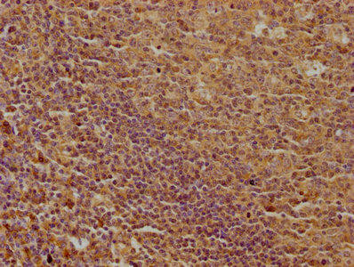 LPAR5 Antibody (PACO61947)