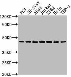 CSNK2A3 Antibody (PACO61999)